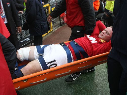 Rooney: Injured against Fulham