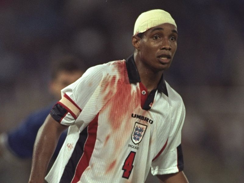 Paul Ince received a cut to his head and played on with a bandage