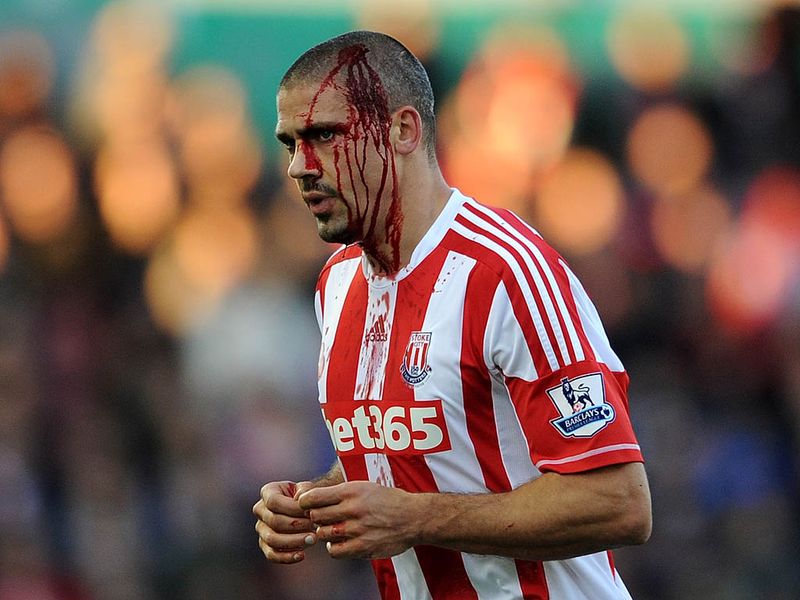 Jon Walters takes a nasty knock to the head as Stoke City face Queens Park Rangers at The Britannia.