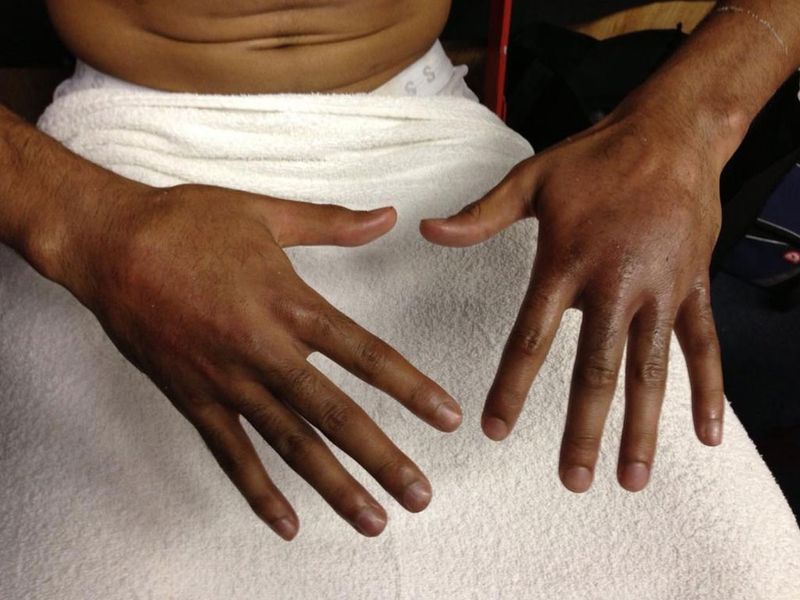 Khan hands were in a mess after the 10 rounds