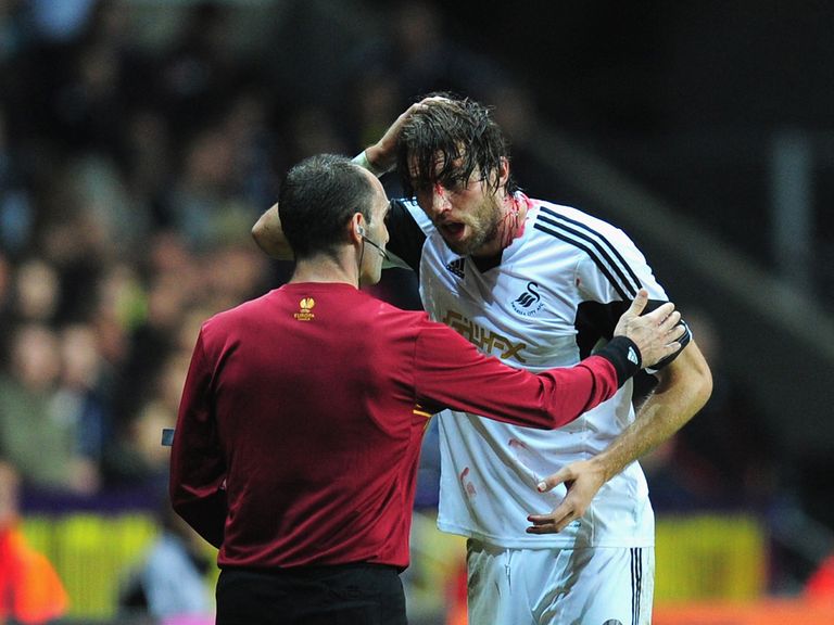 Michu: Played on after suffering a cut head