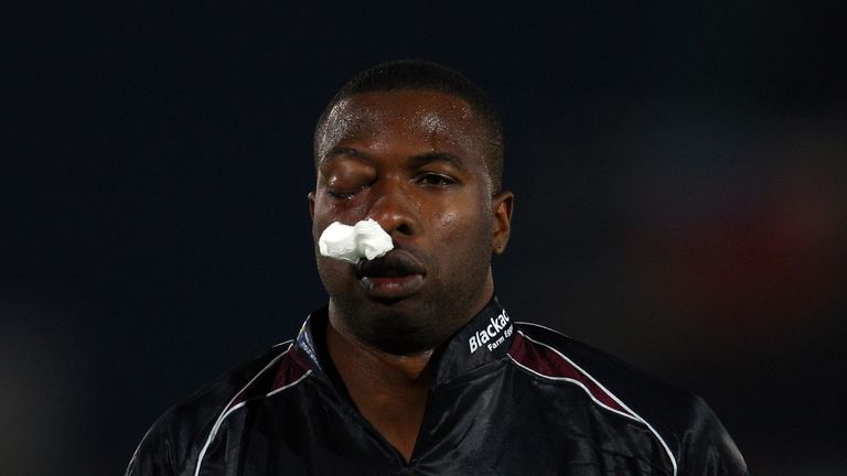 Kieron Pollard: Left looking a bit of a mess after being struck in the face whilst batting