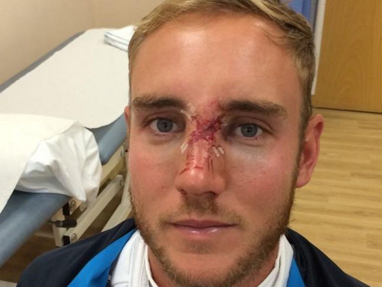 Stuart Broad: Missed nets on Thursday