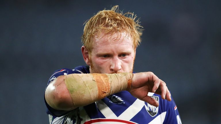 James Graham suffered a neck injury against Cronulla