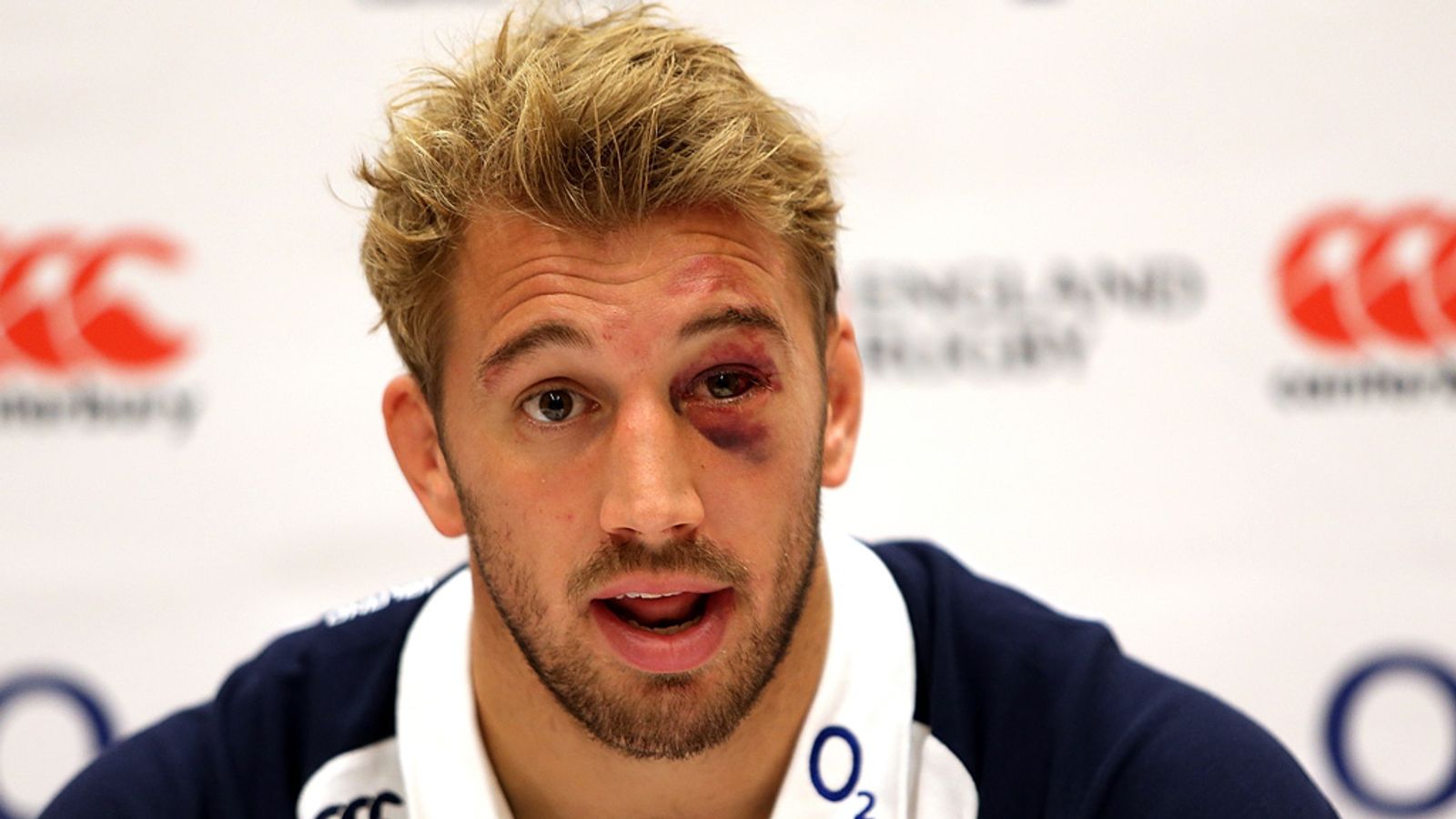 Match Preview - England vs Fiji | 10 Nov 2012