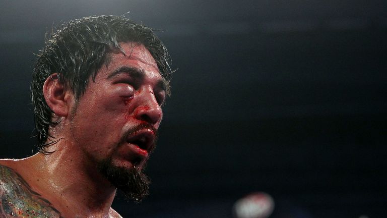 Antonio Margarito sustained damage against Manny Pacquaio and Miguel Cotto