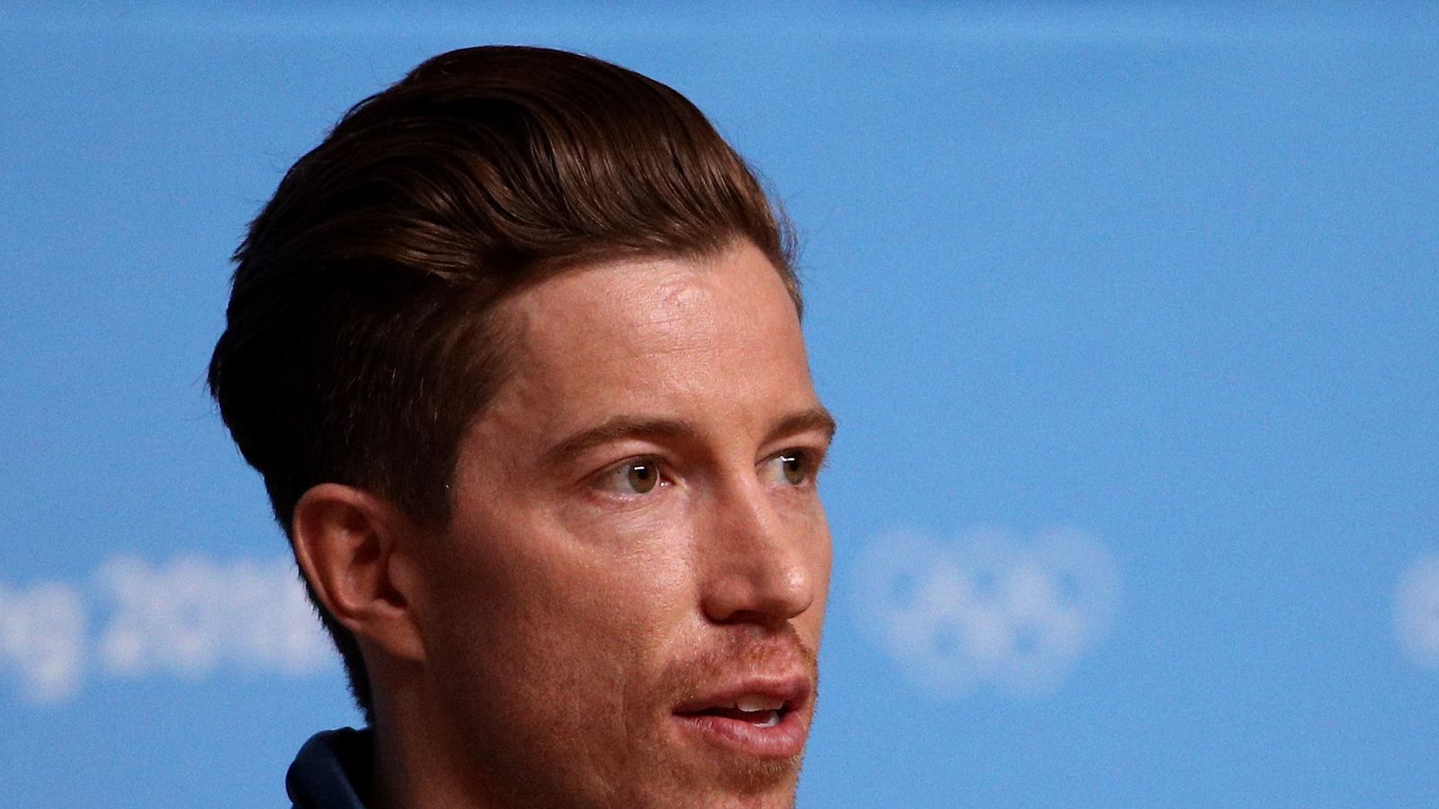 Shaun white. Шон Уайт. Шон Роджер Уайт. Шон Уайт американский музыкант. Шон Уайт шрам.