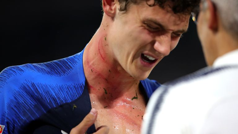 France's Benjamin Pavard was left with nasty stud marks by after being caught by Antonio Rudiger