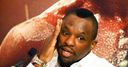 Whyte: Chisora II in massive danger