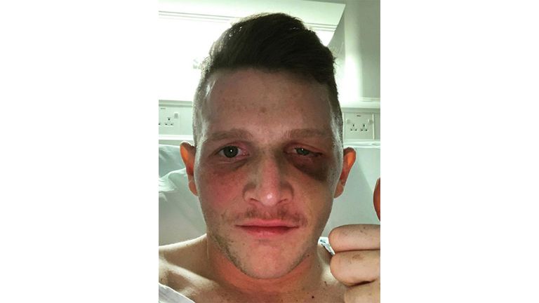 Ward gives a thumbs up from his hospital bed (@samuel_ward13)