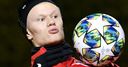 Klopp: Tough to stop 'exceptional' Haaland