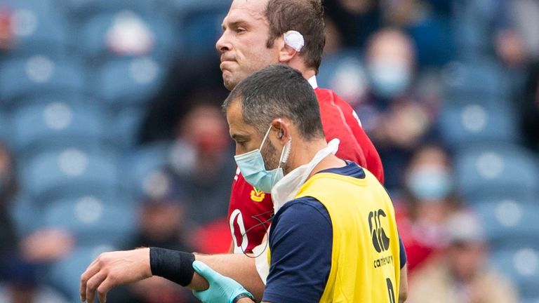Alun Wyn Jones left the field with an injury early on in the fixture