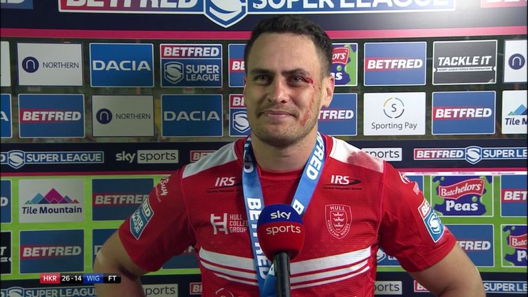 A battered Brad Takairangi is looking forward to the derby as Rovers take on Hull FC next Saturday