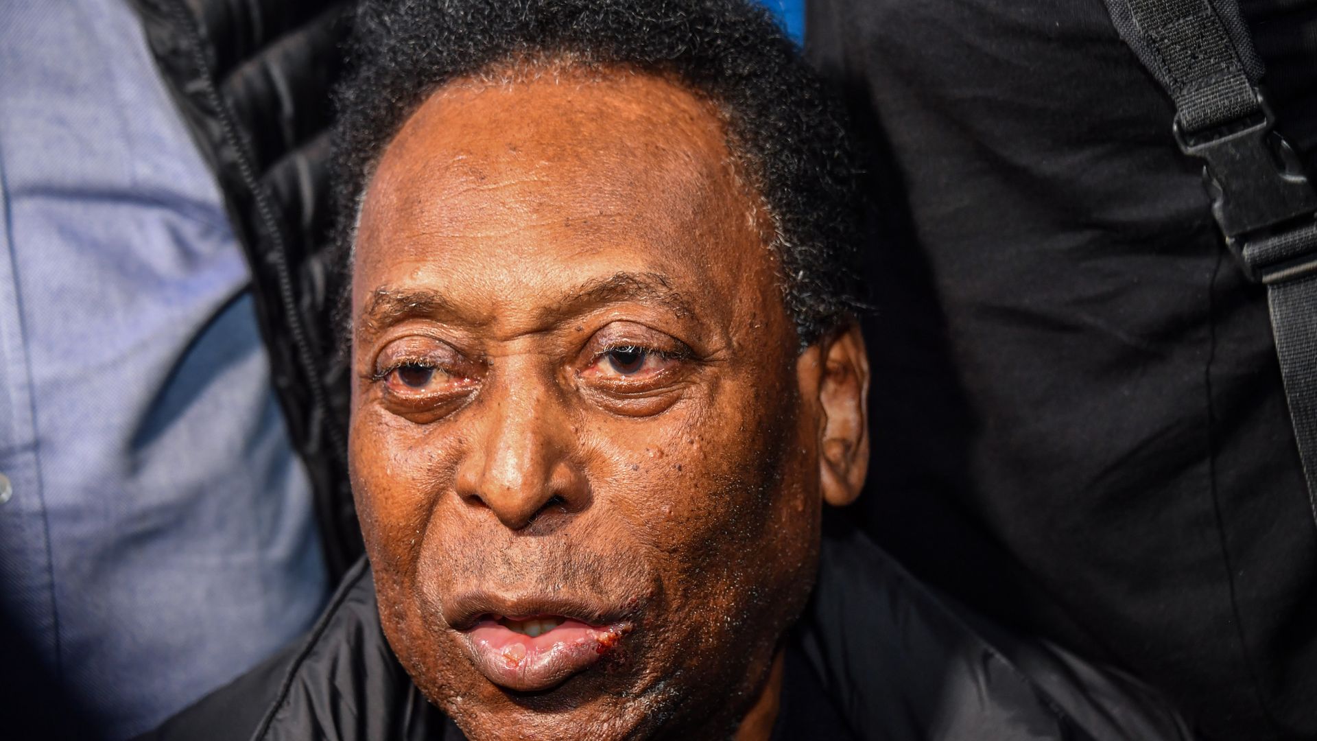 Pele ready for 'extra time' after leaving ICU