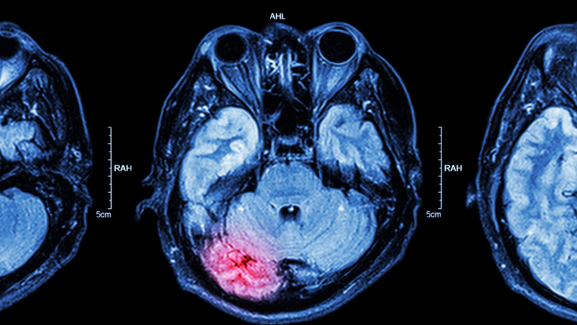 World Rugby launches Brain Health Initiative