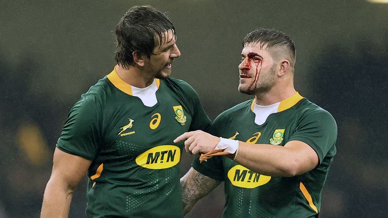 A bloodied Malcolm Marx celebrates his try after the Springboks pack mauled over for a late winner 