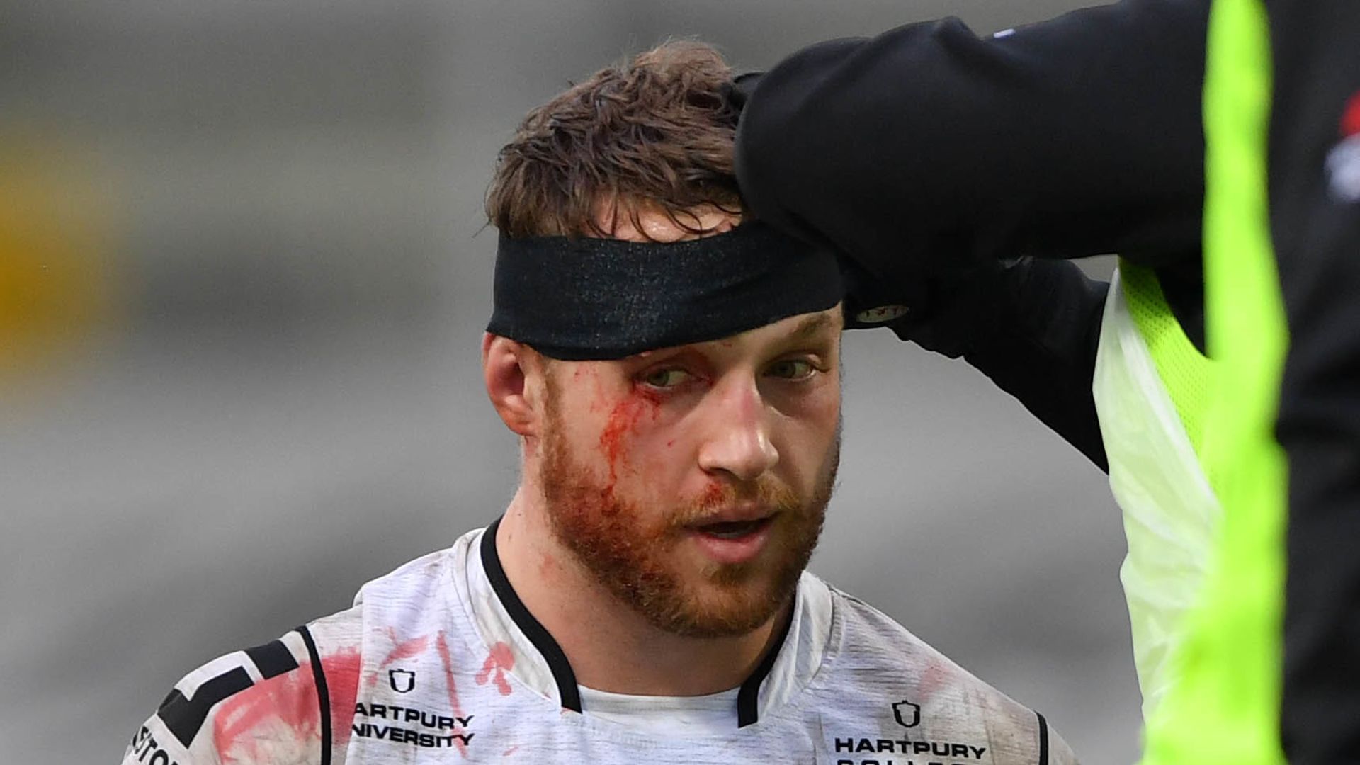 World Rugby to introduce mouthguards to detect concussion