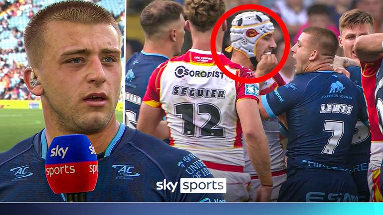 Hull KR's Mikey Lewis says Catalans Dragons full-back Cesar Rouge bit down on his hand during their clash during Magic Weekend