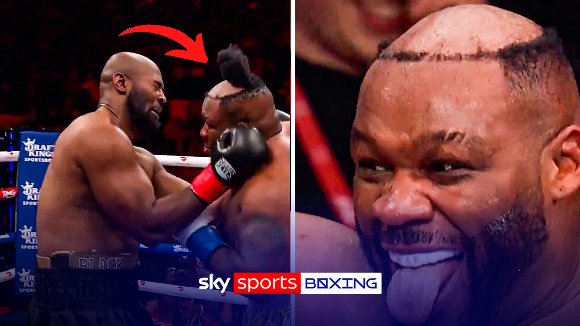 Boxer has hairpiece PUNCHED OFF | Jarrell 'Big Baby' Miller loses hair but wins fight!