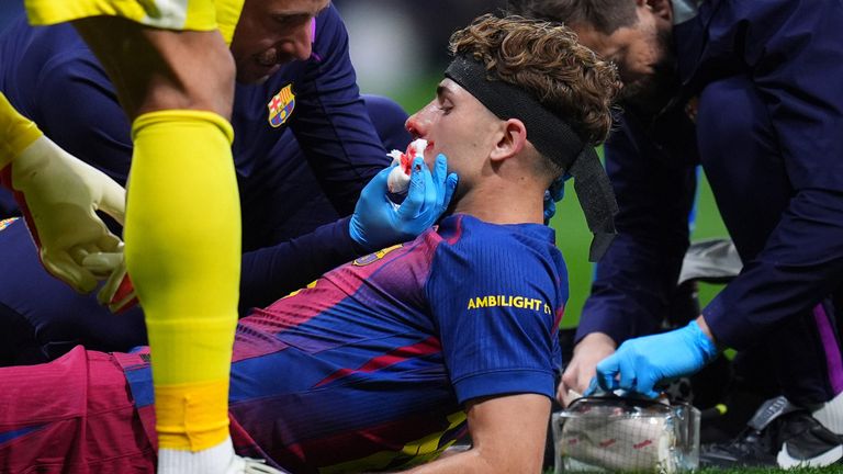 Fermin Lopez blutet nach dem Gesichtstreffer stark und muss lange behandelt werden. 