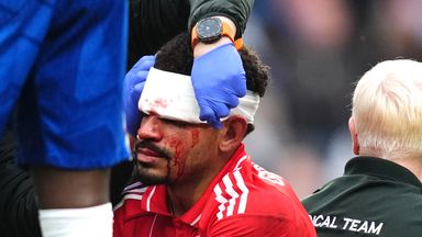 Nottingham Forest's Morgan Gibbs-White receives treatment for a head injury after a clash with Chelsea goalkeeper Robert Sanchez during the 